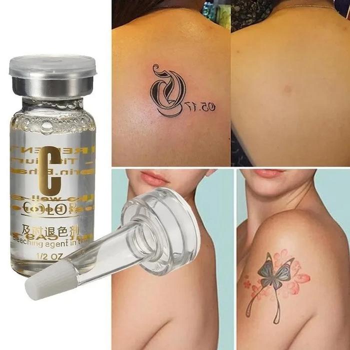 10ml Fast and Easy Tattoo Removal Serum