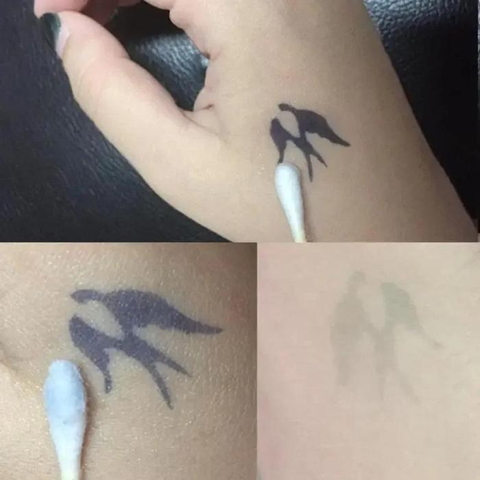 10ml Fast and Easy Tattoo Removal Serum