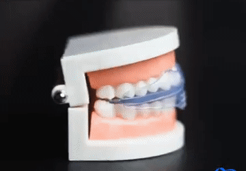 Adult Orthodontic Teeth Straightener for Alignment and Grinding