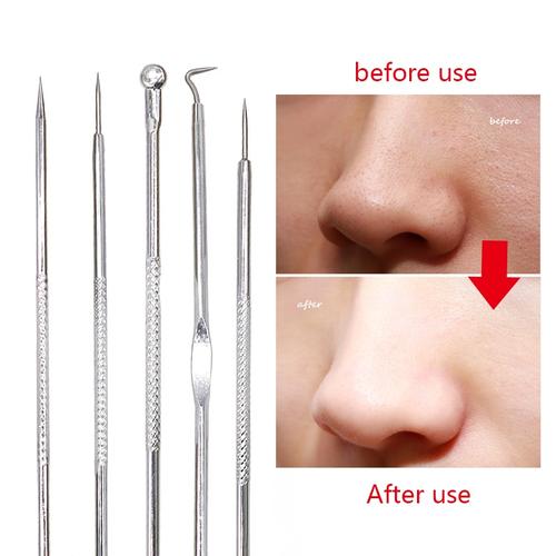 Aluminum Cylinder Mounted Acne Needle Set Of 10 Pieces