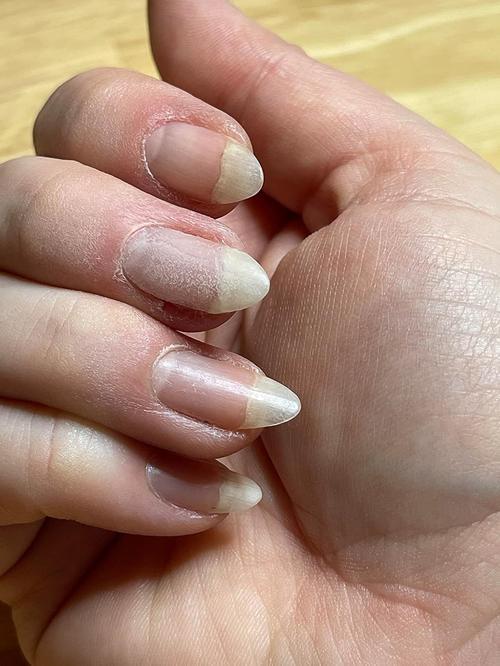 Strong Fiber Nail Repair Gel Clear Polish photo review