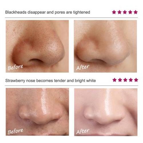 Fashion Minimalist Moisturizing Mask Blackhead Removal Pore Cleansing