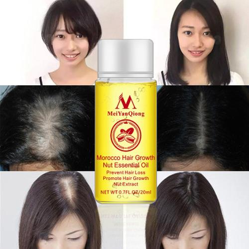 Hair Growth Oil