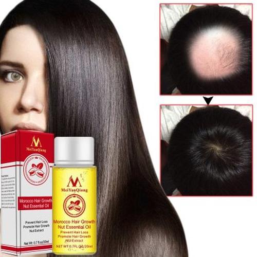 Hair Growth Oil