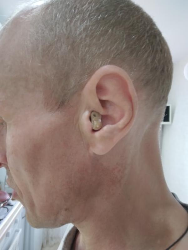 Invisible In-Ear Hearing Aid Sound Amplifier photo review