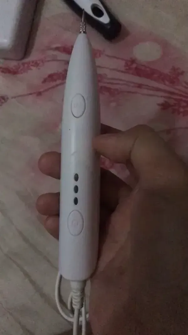 Ion Laser Dark Spot Remover Pen photo review