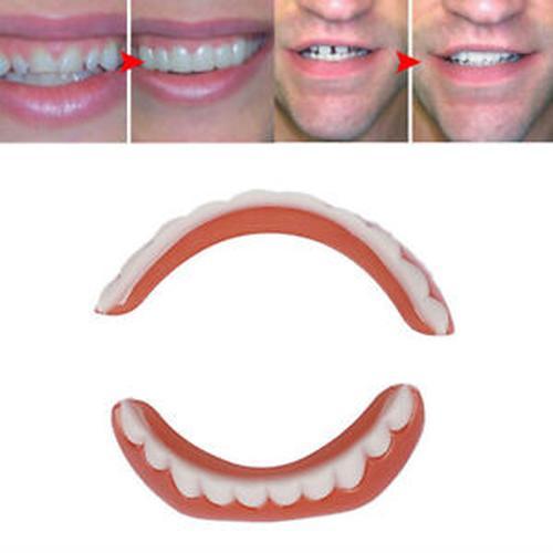 Magic Teeth Brace Veneer