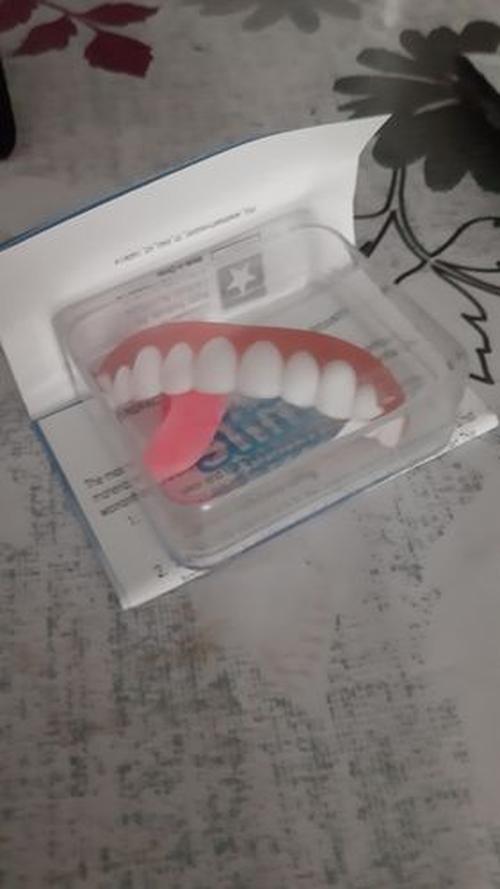 Magic Teeth Brace Veneer photo review