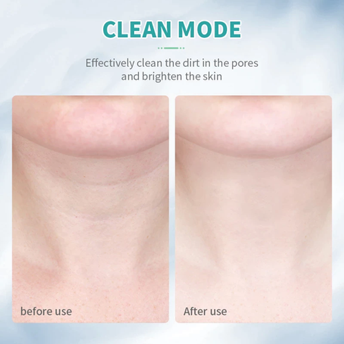 Neck Face LED Photon Therapy Skin Tighten Reduce Double Chin