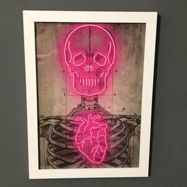 Neon Skeleton Vintage Diagram Art Print - Medical Poster photo review