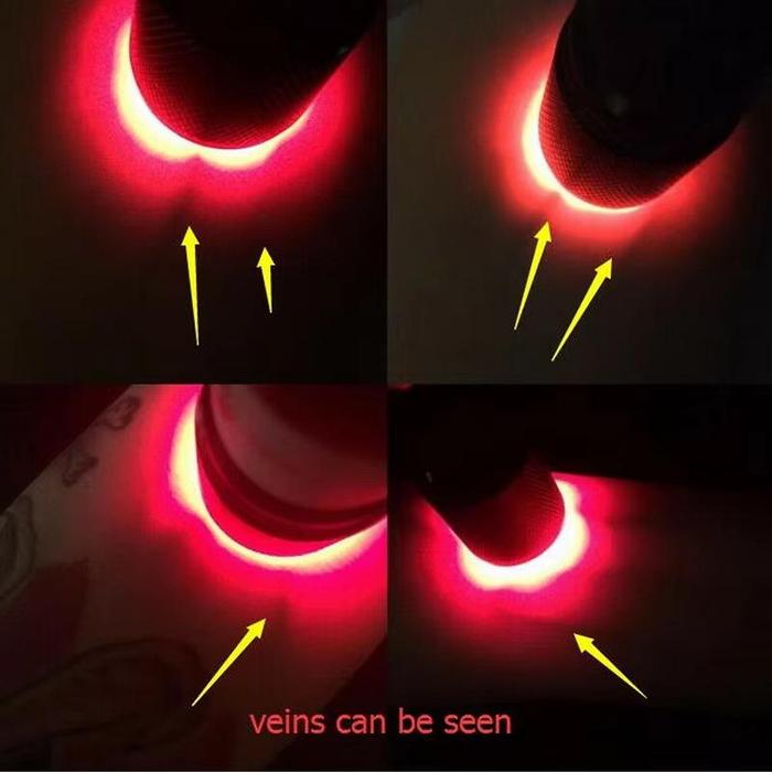 Professional Vein Finder Transilluminator Black Vein Finder Light