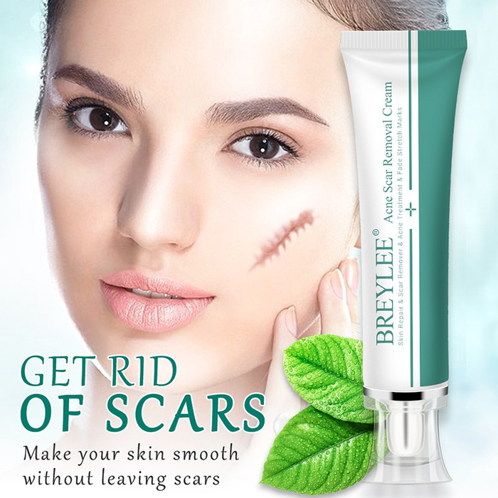 Scar Removal &amp; Repair Cream for Smooth, Clear Complexion