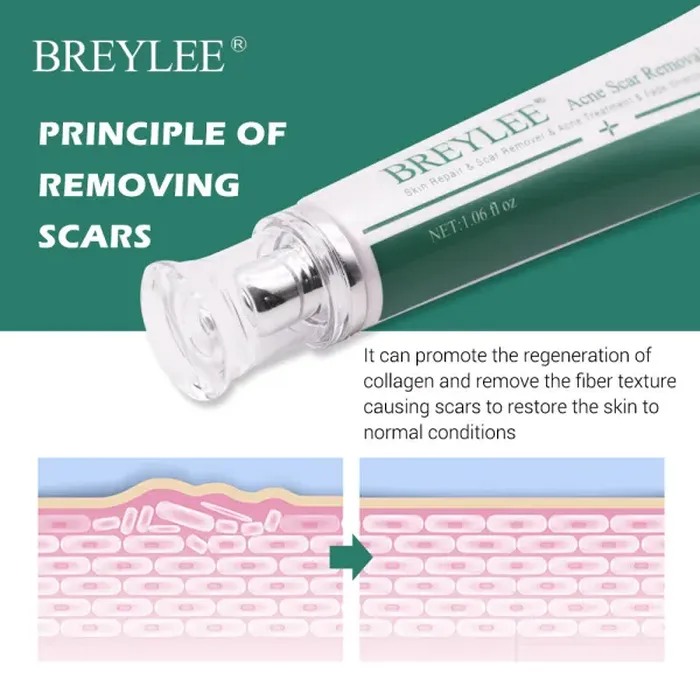 Scar Removal &amp; Repair Cream for Smooth, Clear Complexion
