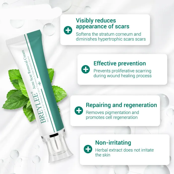 Scar Removal &amp; Repair Cream for Smooth, Clear Complexion