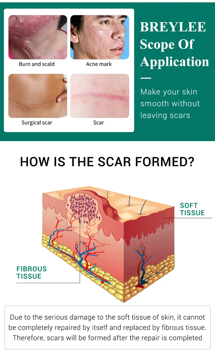 Scar Removal &amp; Repair Cream for Smooth, Clear Complexion