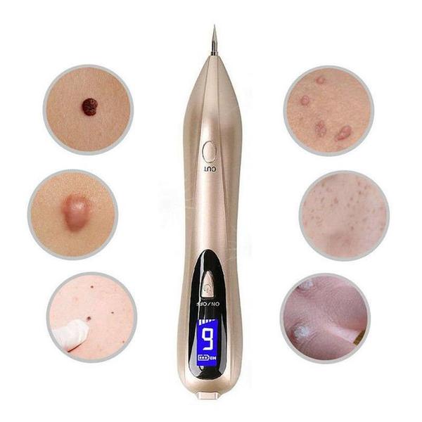 Skin Tag Remover Pen, Mole And Wart Removal