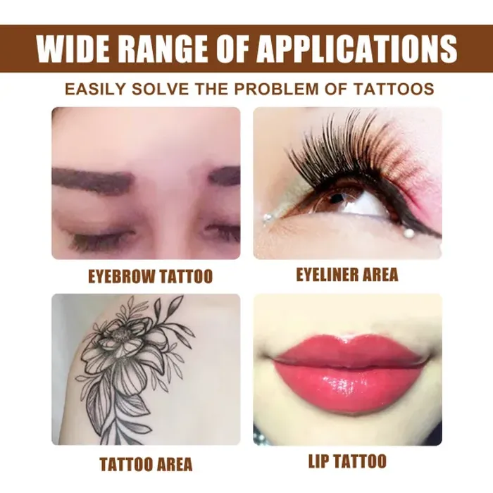 Tattoo Removal Solution – Skin Repair &amp; Pigment Fading Serum