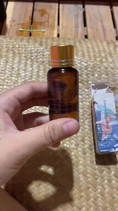 Tattoo Removal Solution – Skin Repair & Pigment Fading Serum photo review