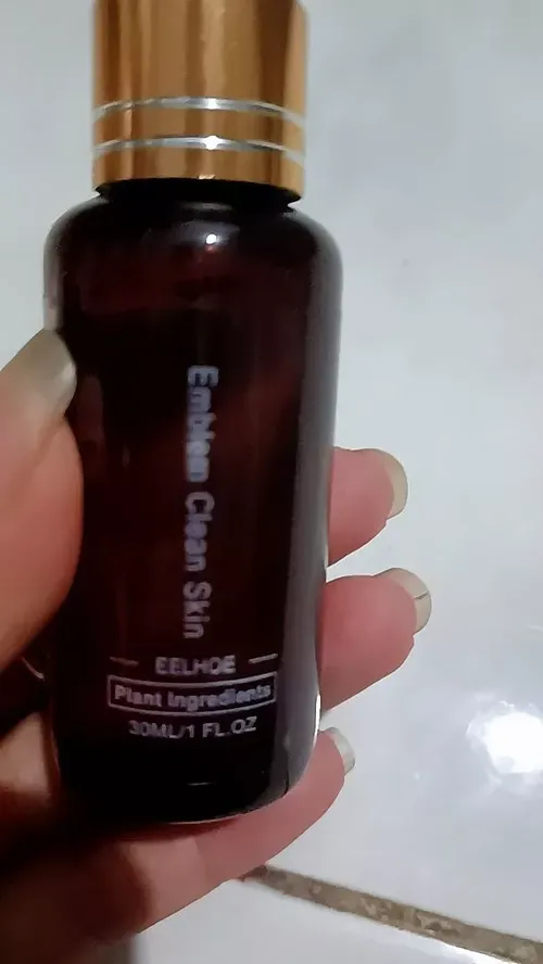 Tattoo Removal Solution – Skin Repair & Pigment Fading Serum photo review