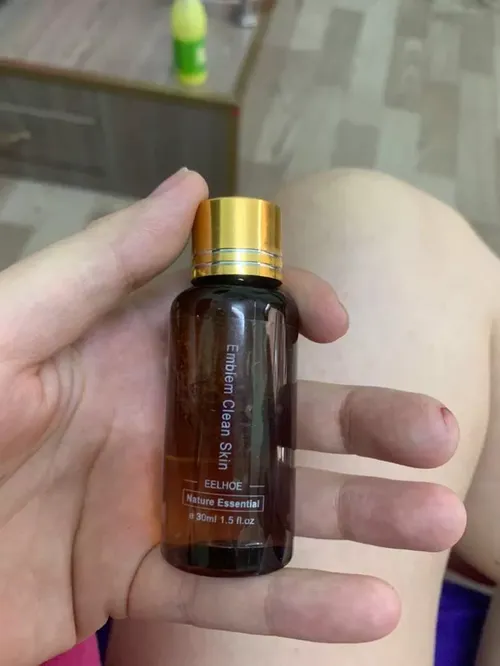 Tattoo Removal Solution – Skin Repair & Pigment Fading Serum photo review