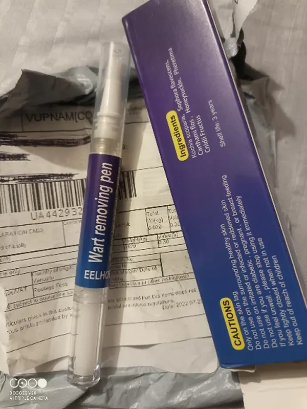 Wart Removal Pen photo review