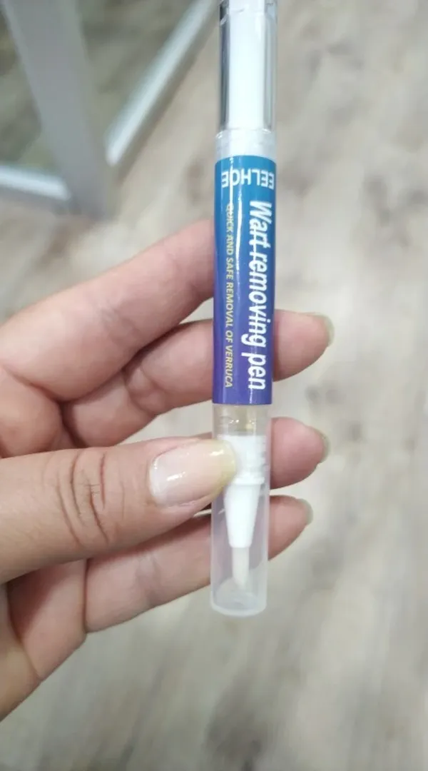 Wart Removal Pen photo review