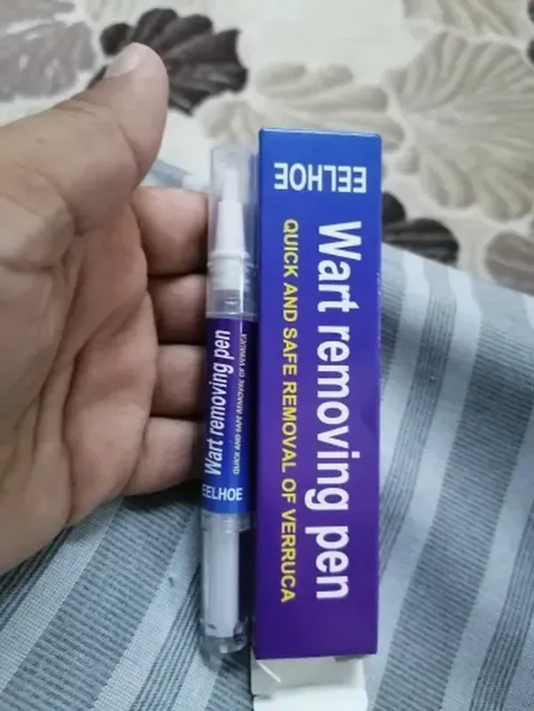 Wart Removal Pen for Skin Tags, Warts, and Corns - Natural Formula for Fast Healing photo review